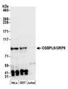 OSBPL9 Antibody - Detection of human OSBPL9/ORP9 by western blot. Samples: Whole cell lysate (50 µg) from HeLa, HEK293T, and Jurkat cells prepared using NETN lysis buffer. Antibody: Affinity purified rabbit anti-OSBPL9/ORP9 antibody used for WB at 0.4 µg/ml. Detection: Chemiluminescence with an exposure time of 30 seconds.