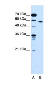 OSBPL9 Antibody - OSBPL9 antibody ARP45659_P050-NP_683702-OSBPL9(oxysterol binding protein-like 9) Antibody Western blot of Jurkat lysate.  This image was taken for the unconjugated form of this product. Other forms have not been tested.