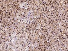 OSBPL9 Antibody - Immunochemical staining of human OSBPL9 in human adrenal gland with rabbit polyclonal antibody at 1:500 dilution, formalin-fixed paraffin embedded sections.