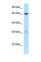 OSCAR Antibody - OSCAR antibody Western blot of Fetal Kidney lysate. Antibody concentration 1 ug/ml.  This image was taken for the unconjugated form of this product. Other forms have not been tested.
