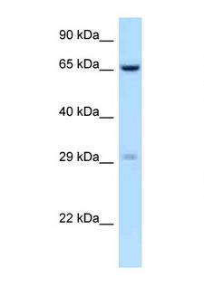 OSCAR Antibody - OSCAR antibody Western blot of Fetal Kidney lysate. Antibody concentration 1 ug/ml.  This image was taken for the unconjugated form of this product. Other forms have not been tested.