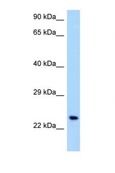 OSCAR Antibody - OSCAR antibody Western blot of Jurkat Cell lysate. Antibody concentration 1 ug/ml.  This image was taken for the unconjugated form of this product. Other forms have not been tested.