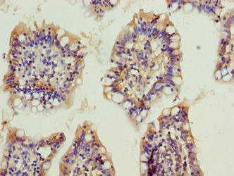 OSER1 / C20orf111 Antibody - Immunohistochemistry of paraffin-embedded human small intestine tissue using OSER1 Antibody at dilution of 1:100