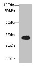 OSER1 / C20orf111 Antibody - Western blot All lanes: OSER1 antibody at 3µg/ml + Mouse liver tissue Secondary Goat polyclonal to rabbit IgG at 1/10000 dilution Predicted band size: 32 kDa Observed band size: 32 kDa