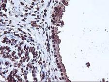 OSGEP Antibody - IHC of paraffin-embedded Human breast tissue using anti-OSGEP mouse monoclonal antibody.