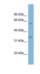 OSGEP Antibody - OSGEP antibody Western blot of 721_B cell lysate. This image was taken for the unconjugated form of this product. Other forms have not been tested.