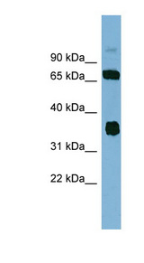 OSGEP Antibody - OSGEP antibody Western blot of MCF7 cell lysate. This image was taken for the unconjugated form of this product. Other forms have not been tested.