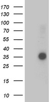 OSGEP Antibody - HEK293T cells were transfected with the pCMV6-ENTRY control (Left lane) or pCMV6-ENTRY OSGEP (Right lane) cDNA for 48 hrs and lysed. Equivalent amounts of cell lysates (5 ug per lane) were separated by SDS-PAGE and immunoblotted with anti-OSGEP.