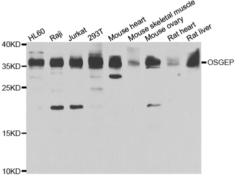 OSGEP Antibody - Western blot analysis of extracts of various cell lines.