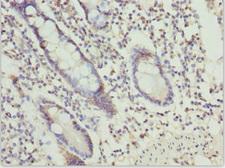 OSGEP Antibody - Immunohistochemistry of paraffin-embedded human small intestine tissue at dilution 1:100