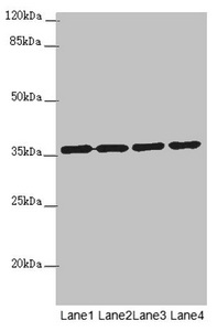OSGEP Antibody - Western blot All Lanes:OSGEP antibody at 3.18ug/ml Lane 1 : 293T whole cell lysate Lane 2 : Jurkat whole cell lysate Lane 3 : Raji whole cell lysate Lane 4 : PC-3 whole cell lysate Secondary Goat polyclonal to Rabbit IgG at 1/10000 dilution Predicted band size: 36 kDa Observed band size: 36 kDa