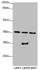 OSGEP Antibody - Western blot All Lanes:OSGEP antibody at 2.04ug/ml Lane 1 : Jurkat whole cell lysate Lane 2 : Raji whole cell lysate Lane 3 : PC-3 whole cell lysate Secondary Goat polyclonal to Rabbit IgG at 1/10000 dilution Predicted band size: 36 kDa Observed band size: 36,25 kDa