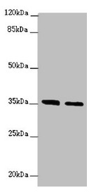 OSGEP Antibody - Western blot All lanes: OSGEP antibody at 2.04µg/ml Lane 1: Jurkat whole cell lysate Lane 2: PC-3 whole cell lysate Secondary Goat polyclonal to rabbit IgG at 1/10000 dilution Predicted band size: 36 kDa Observed band size: 36 kDa