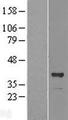 OSGEP Protein - Western validation with an anti-DDK antibody * L: Control HEK293 lysate R: Over-expression lysate