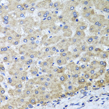 OSGEPL1 Antibody - Immunohistochemistry of paraffin-embedded human liver injury tissue.