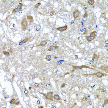 OSGEPL1 Antibody - Immunohistochemistry of paraffin-embedded rat brain tissue.