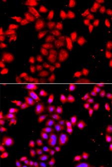 OSGEPL1 Antibody - Immunofluorescence analysis of A549 cells.