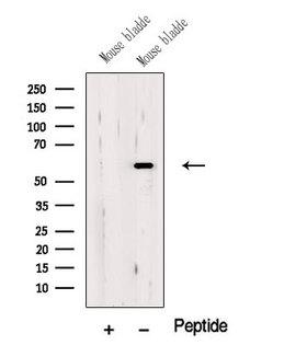 OSGIN1 Antibody - Western blot analysis of extracts of mouse bladder tissue using OSGI1 antibody. The lane on the left was treated with blocking peptide.