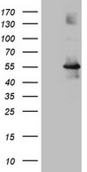 OSGIN2 Antibody - HEK293T cells were transfected with the pCMV6-ENTRY control. (Left lane) or pCMV6-ENTRY OSGIN2. (Right lane) cDNA for 48 hrs and lysed. Equivalent amounts of cell lysates. (5 ug per lane) were separated by SDS-PAGE and immunoblotted with anti-OSGIN2. (1:2000)