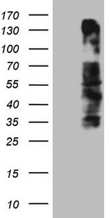 OSGIN2 Antibody - HEK293T cells were transfected with the pCMV6-ENTRY control. (Left lane) or pCMV6-ENTRY OSGIN2. (Right lane) cDNA for 48 hrs and lysed. Equivalent amounts of cell lysates. (5 ug per lane) were separated by SDS-PAGE and immunoblotted with anti-OSGIN2. (1:2000)