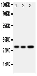 OSM / Oncostatin M Antibody - Anti-Oncostatin M antibody, Western blotting All lanes: Anti Oncostatin M at 0.5ug/ml Lane 1: A549 Whole Cell Lysate at 40ug Lane 2: A549 Whole Cell Lysate at 40ug Lane 3: HELA Whole Cell Lysate at 40ug Predicted bind size: 28KD Observed bind size: 28KD