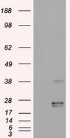 OSM / Oncostatin M Antibody - HEK293T cells were transfected with the pCMV6-ENTRY control (Left lane) or pCMV6-ENTRY OSM (Right lane) cDNA for 48 hrs and lysed. Equivalent amounts of cell lysates (5 ug per lane) were separated by SDS-PAGE and immunoblotted with anti-OSM.