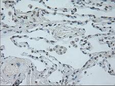 OSM / Oncostatin M Antibody - IHC of paraffin-embedded lung tissue using anti-OSM mouse monoclonal antibody. (Dilution 1:50).