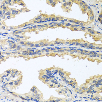 OSM / Oncostatin M Antibody - Immunohistochemistry of paraffin-embedded human prostate using OSM antibody at dilution of 1:100 (40x lens).