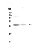 OSM / Oncostatin M Antibody - Western blot - Anti-Oncostatin M Picoband Antibody