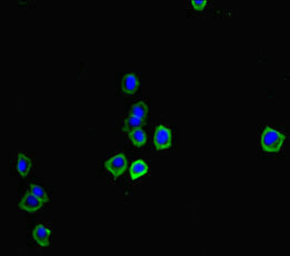 OSM / Oncostatin M Antibody - Immunofluorescent analysis of HepG2 cells diluted at 1:100 and Alexa Fluor 488-congugated AffiniPure Goat Anti-Rabbit IgG(H+L)