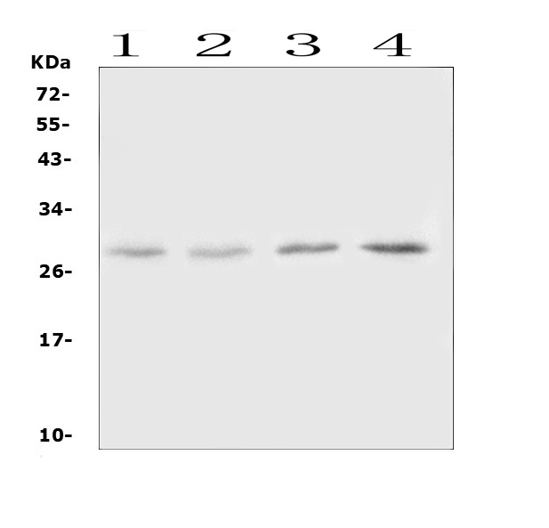 OSM / Oncostatin M Antibody - Western blot analysis of Oncostatin M using anti-Oncostatin M antibody. Electrophoresis was performed on a 5-20% SDS-PAGE gel at 70V (Stacking gel) / 90V (Resolving gel) for 2-3 hours. The sample well of each lane was loaded with 50ug of sample under reducing conditions. Lane 1: rat lung tissue lysates,Lane 2: rat spleen tissue lysates,Lane 3: mouse lung tissue lysates,Lane 4: mouse spleen tissue lysates. After Electrophoresis, proteins were transferred to a Nitrocellulose membrane at 150mA for 50-90 minutes. Blocked the membrane with 5% Non-fat Milk/ TBS for 1.5 hour at RT. The membrane was incubated with rabbit anti-Oncostatin M antigen affinity purified polyclonal antibody at 0.5 µg/mL overnight at 4°C, then washed with TBS-0.1% Tween 3 times with 5 minutes each and probed with a goat anti-rabbit IgG-HRP secondary antibody at a dilution of 1:10000 for 1.5 hour at RT. The signal is developed using an Enhanced Chemiluminescent detection (ECL) kit with Tanon 5200 system. A specific band was detected for Oncostatin M at approximately 28KD. The expected band size for Oncostatin M is at 28KD.