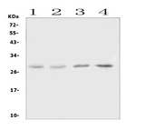 OSM / Oncostatin M Antibody - Western blot analysis of Oncostatin M using anti-Oncostatin M antibody. Electrophoresis was performed on a 5-20% SDS-PAGE gel at 70V (Stacking gel) / 90V (Resolving gel) for 2-3 hours. The sample well of each lane was loaded with 50ug of sample under reducing conditions. Lane 1: rat lung tissue lysates,Lane 2: rat spleen tissue lysates,Lane 3: mouse lung tissue lysates,Lane 4: mouse spleen tissue lysates. After Electrophoresis, proteins were transferred to a Nitrocellulose membrane at 150mA for 50-90 minutes. Blocked the membrane with 5% Non-fat Milk/ TBS for 1.5 hour at RT. The membrane was incubated with rabbit anti-Oncostatin M antigen affinity purified polyclonal antibody at 0.5 µg/mL overnight at 4°C, then washed with TBS-0.1% Tween 3 times with 5 minutes each and probed with a goat anti-rabbit IgG-HRP secondary antibody at a dilution of 1:10000 for 1.5 hour at RT. The signal is developed using an Enhanced Chemiluminescent detection (ECL) kit with Tanon 5200 system. A specific band was detected for Oncostatin M at approximately 28KD. The expected band size for Oncostatin M is at 28KD.