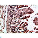 OSM / Oncostatin M Antibody - Immunohistochemical analysis of paraffin-embedded human-colon, antibody was diluted at 1:200.