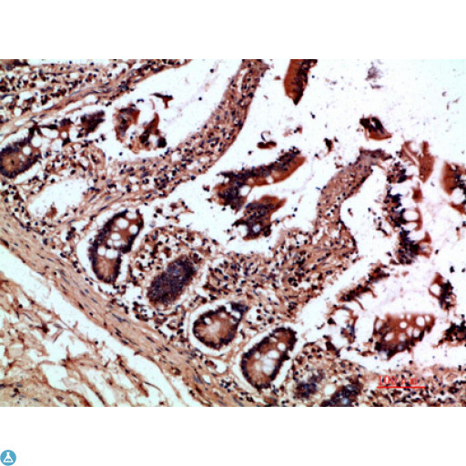 OSM / Oncostatin M Antibody - Immunohistochemical analysis of paraffin-embedded human-colon, antibody was diluted at 1:200.