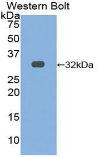 OSMR / IL-31R-Beta Antibody - Western blot of recombinant OSMR.  This image was taken for the unconjugated form of this product. Other forms have not been tested.