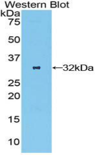 OSMR / IL-31R-Beta Antibody - Western blot of recombinant OSMR.  This image was taken for the unconjugated form of this product. Other forms have not been tested.