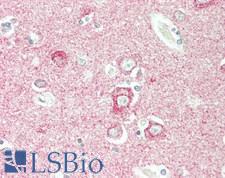 OSMR / IL-31R-Beta Antibody - Human Brain, Cortex: Formalin-Fixed, Paraffin-Embedded (FFPE)