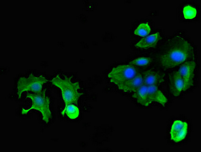 OSMR / IL-31R-Beta Antibody - Immunofluorescent analysis of MCF-7 cells diluted at 1:100 and Alexa Fluor 488-congugated AffiniPure Goat Anti-Rabbit IgG(H+L)