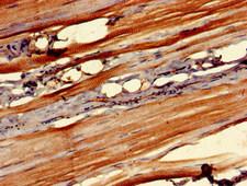 OSMR / IL-31R-Beta Antibody - Immunohistochemistry of paraffin-embedded human skeletal muscle tissue at dilution of 1:100