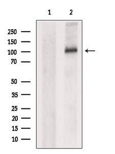 OSMR / IL-31R-Beta Antibody