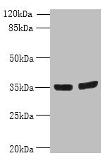OSR2 Antibody - Western blot All lanes: OSR2 antibody at 7µg/ml Lane 1: Jurkat whole cell lysate Lane 2: Hela whole cell lysate Secondary Goat polyclonal to rabbit IgG at 1/10000 dilution Predicted band size: 36, 31, 49 kDa Observed band size: 36 kDa