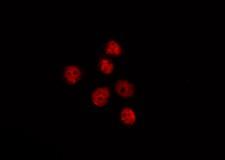 OSR2 Antibody - Staining HepG2 cells by IF/ICC. The samples were fixed with PFA and permeabilized in 0.1% Triton X-100, then blocked in 10% serum for 45 min at 25°C. The primary antibody was diluted at 1:200 and incubated with the sample for 1 hour at 37°C. An Alexa Fluor 594 conjugated goat anti-rabbit IgG (H+L) Ab, diluted at 1/600, was used as the secondary antibody.