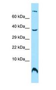 OST4 Antibody - OST4 antibody Western Blot of MCF7.  This image was taken for the unconjugated form of this product. Other forms have not been tested.