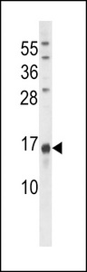 Osteocalcin Antibody - Osteocalcin Antibody western blot of U251 cell line lysates (35 ug/lane). The Osteocalcin antibody detected the Osteocalcin protein (arrow).