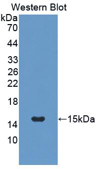 Osteocalcin Antibody - Western blot of Osteocalcin antibody.