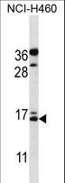 Osteocalcin Antibody - BGLAP Antibody western blot of NCI-H460 cell line lysates (35 ug/lane). The BGLAP antibody detected the BGLAP protein (arrow).