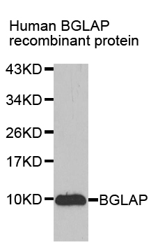 Osteocalcin Antibody - Western blot analysis of extracts of recombinant protein.