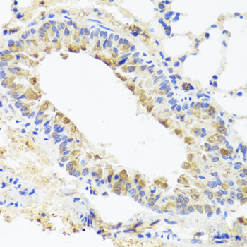 Osteocalcin Antibody - Immunohistochemistry of paraffin-embedded mouse lung tissue.