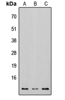 Osteocalcin Antibody - Western blot analysis of Osteocalcin expression in HEK293T (A); Raw264.7 (B); H9C2 (C) whole cell lysates.