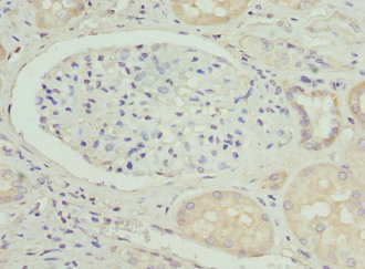 Osteocalcin Antibody - Immunohistochemistry of paraffin-embedded human kidney tissue using BGLAP Antibody at dilution of 1:100